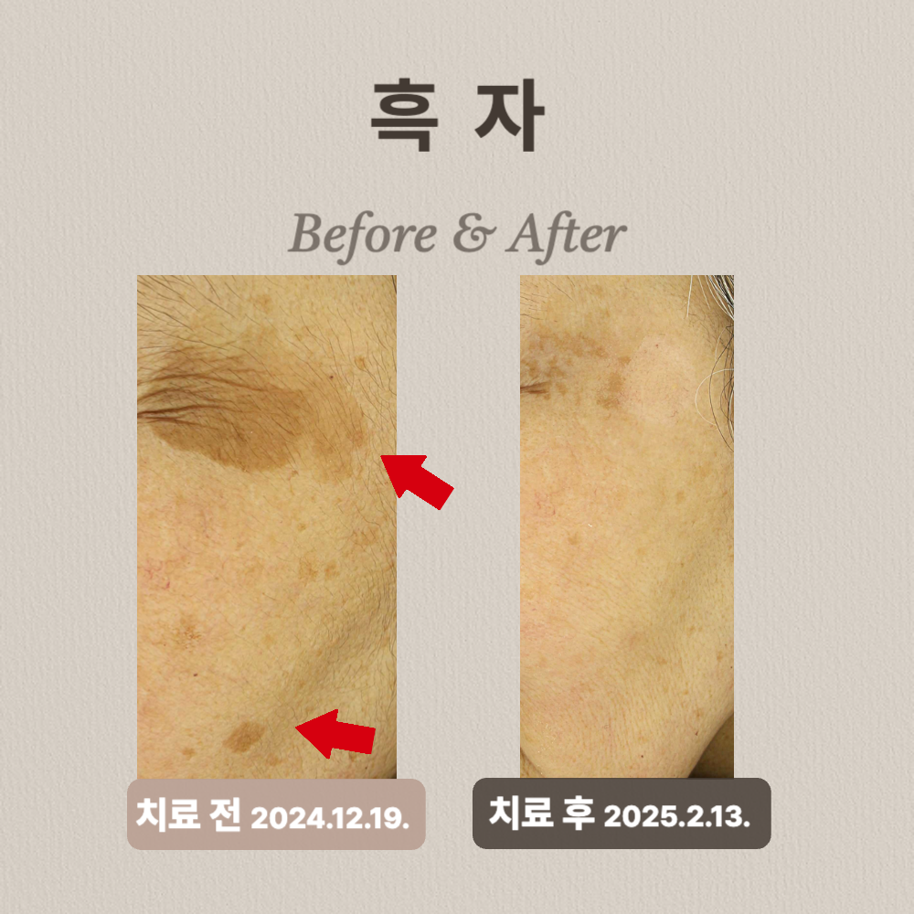 60대 흑자