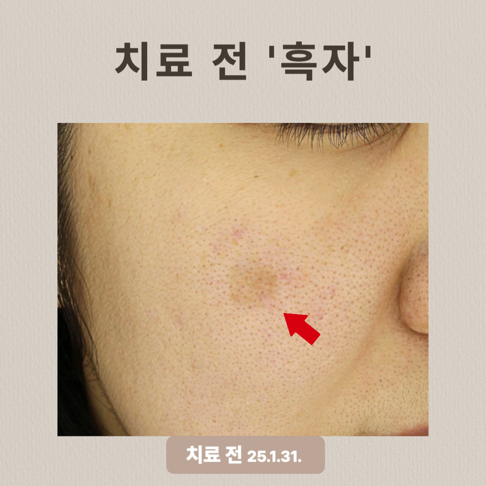 40대 흑자