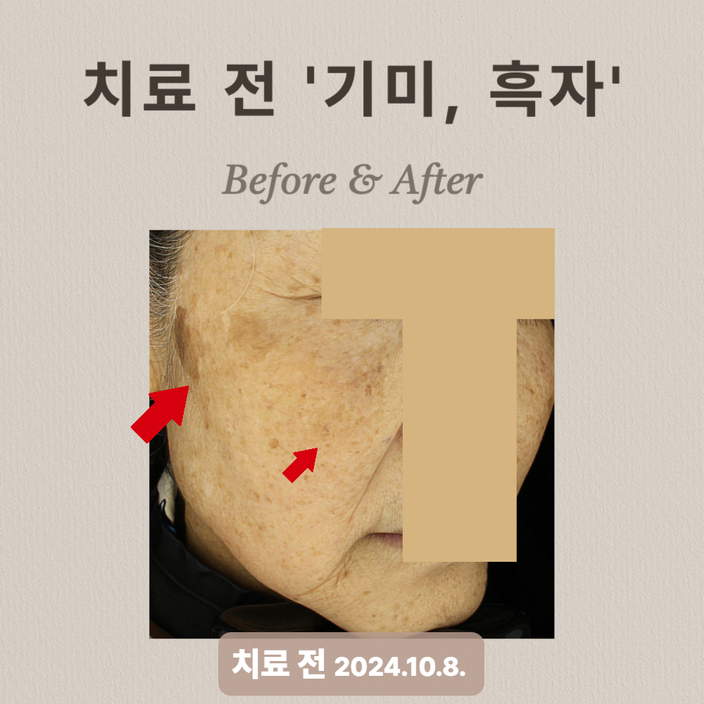 60대 기미, 흑자