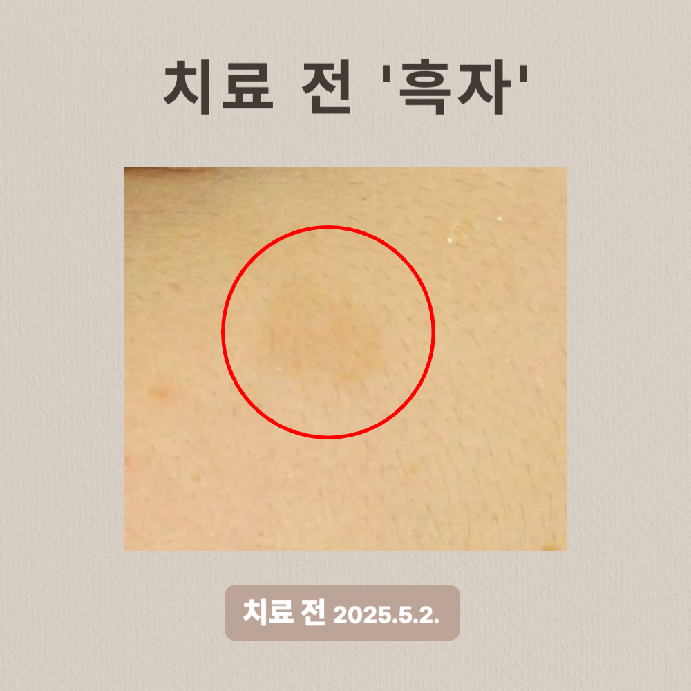 20대 흑자