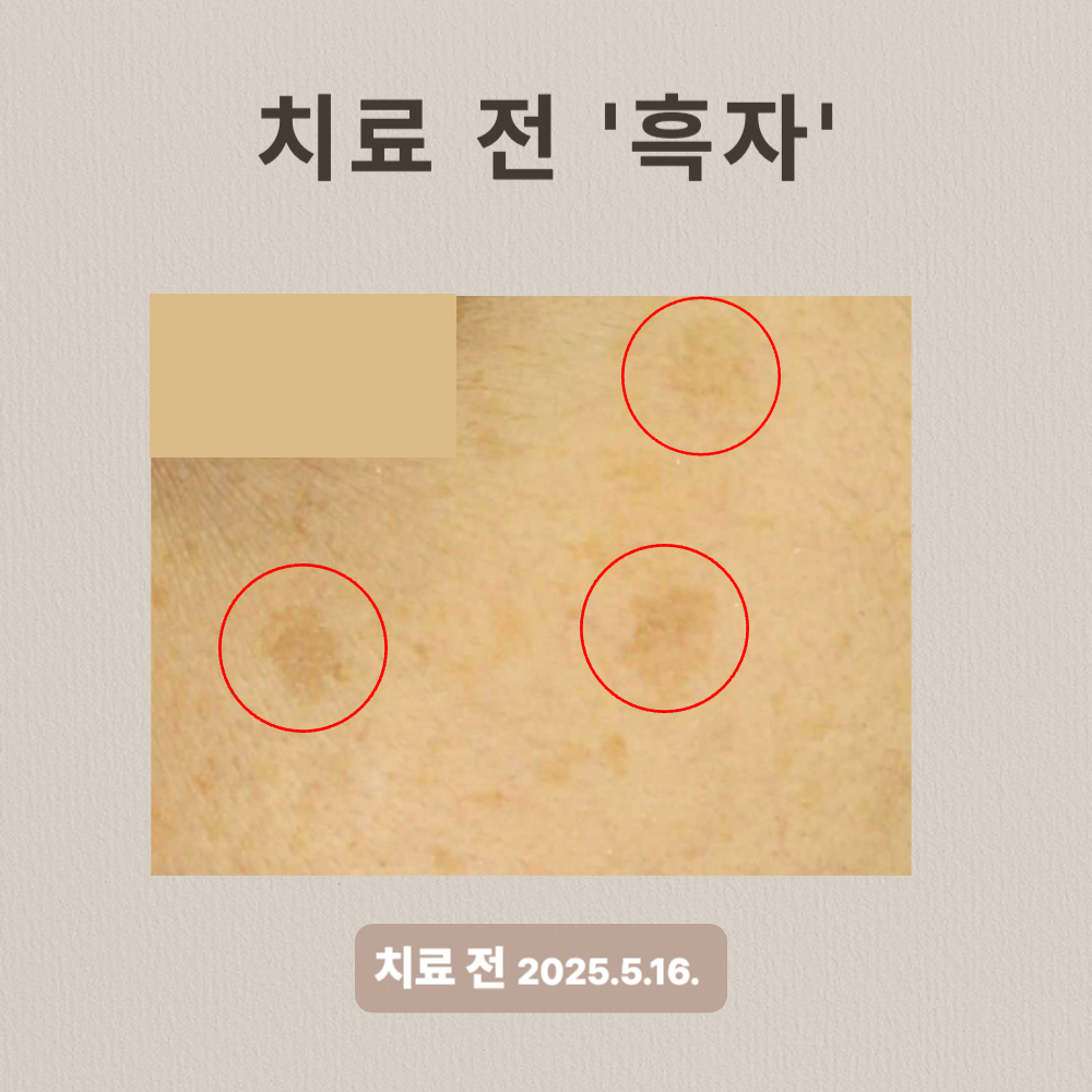 30대 흑자