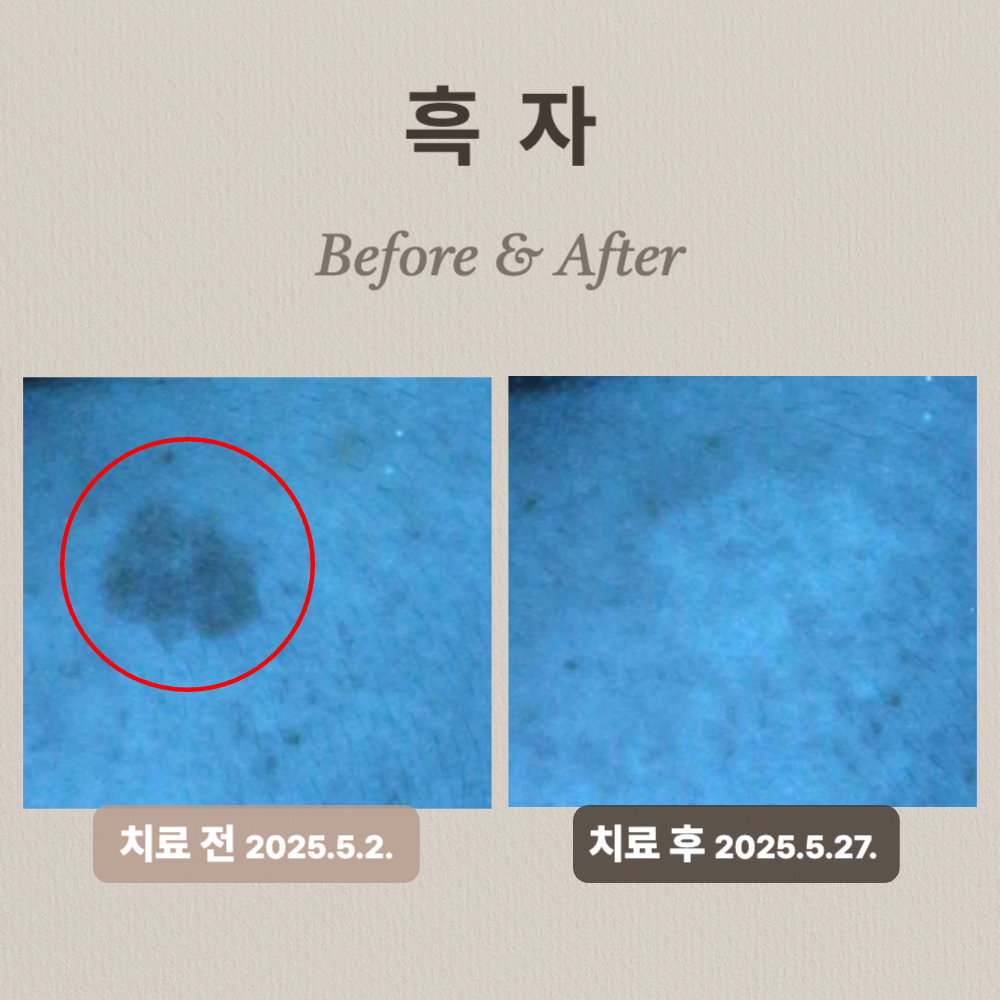 20대 흑자