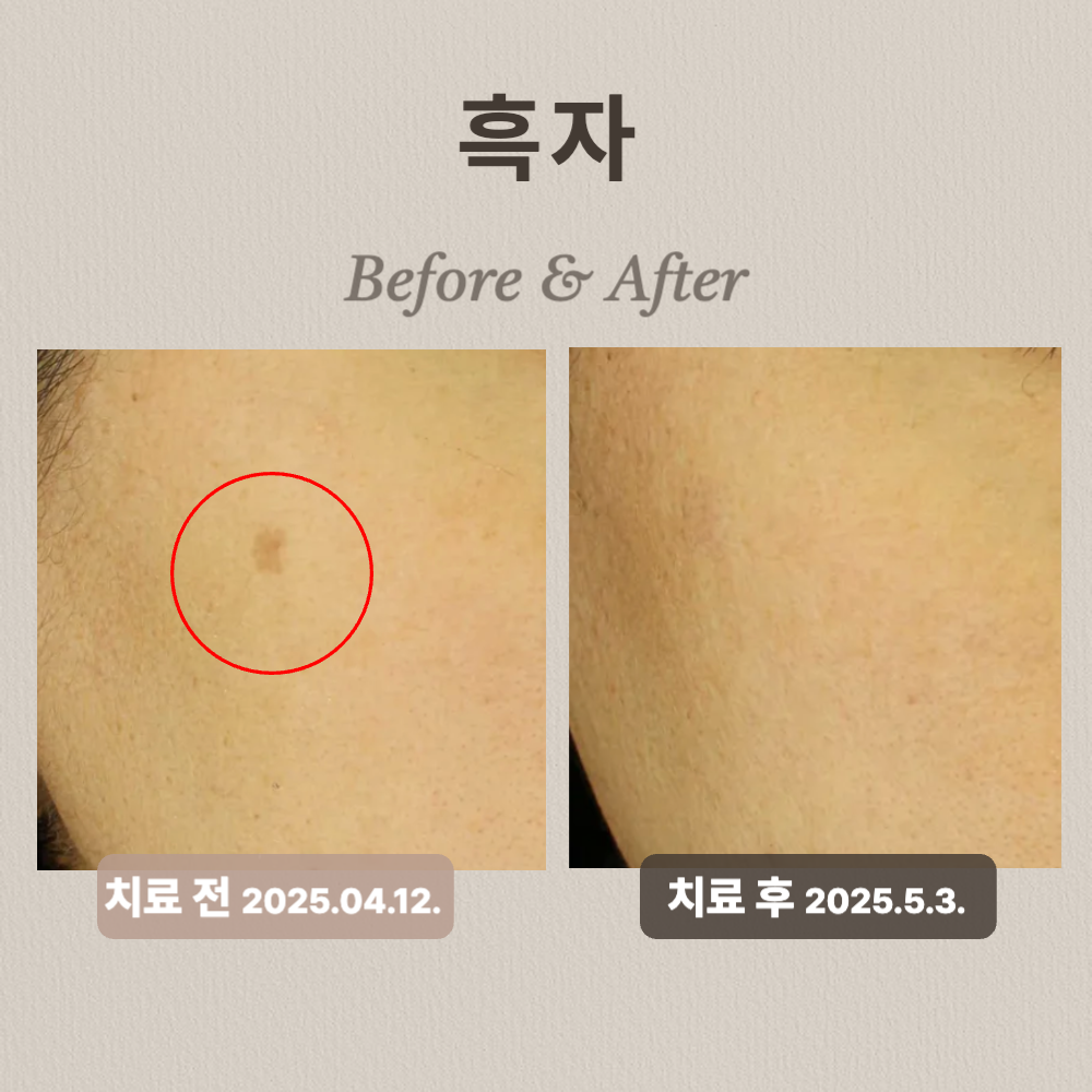 40대 흑자