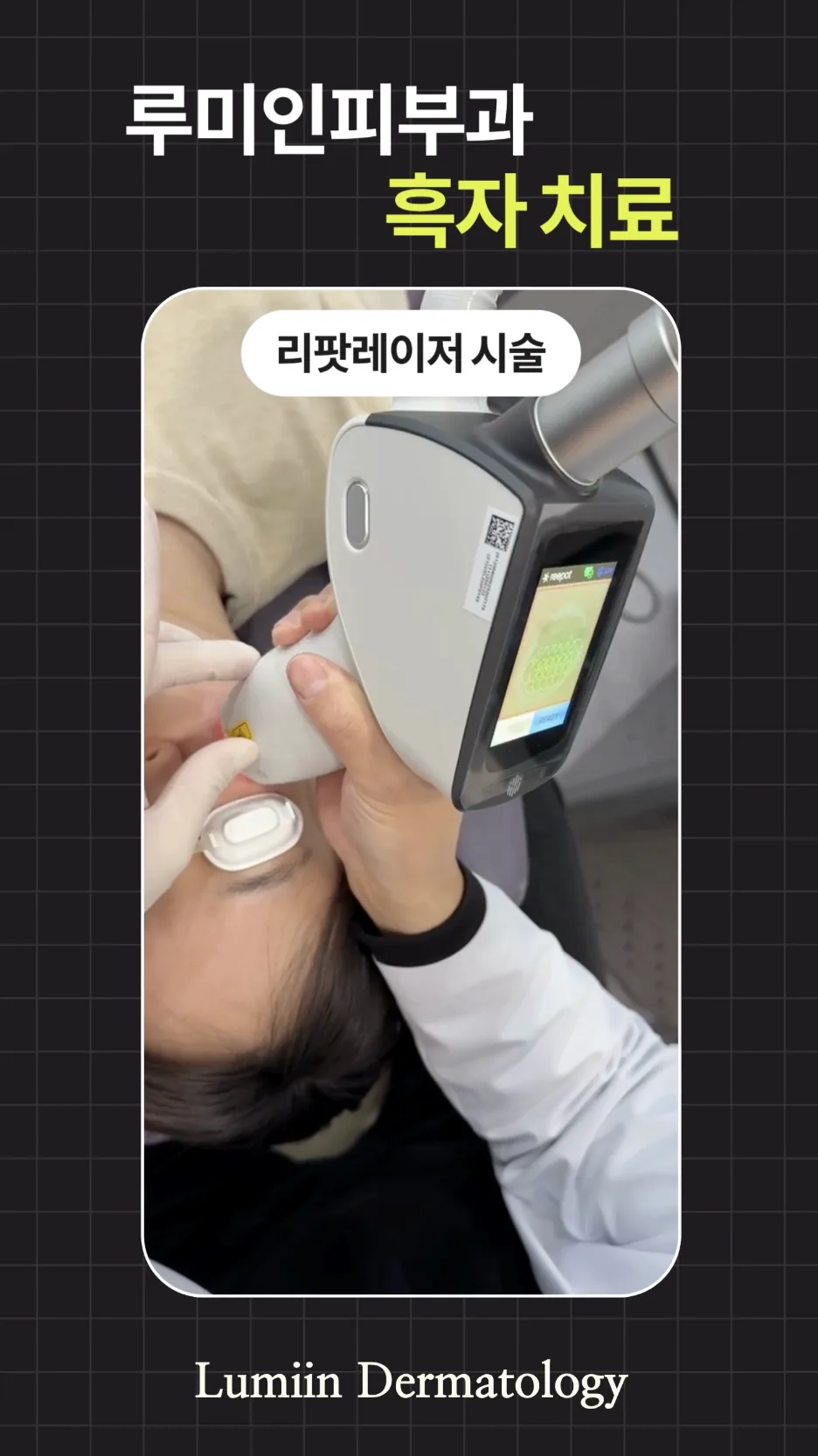 최재원 대표원장이 피부 분석 화면을 보며 색소 병변을 설명하는 상담 장면