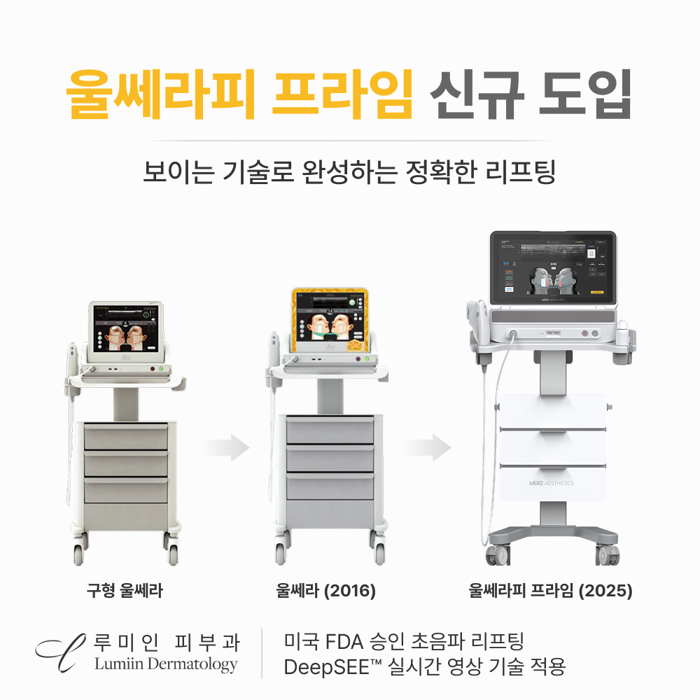 울쎄라피 프라임 신규도입