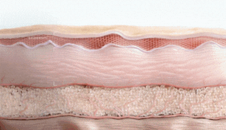 울쎄라 원리 - 3가지 깊이별 시술