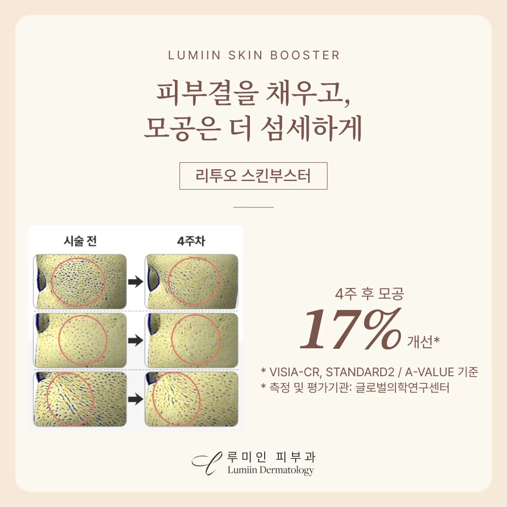 리투오 스킨부스터