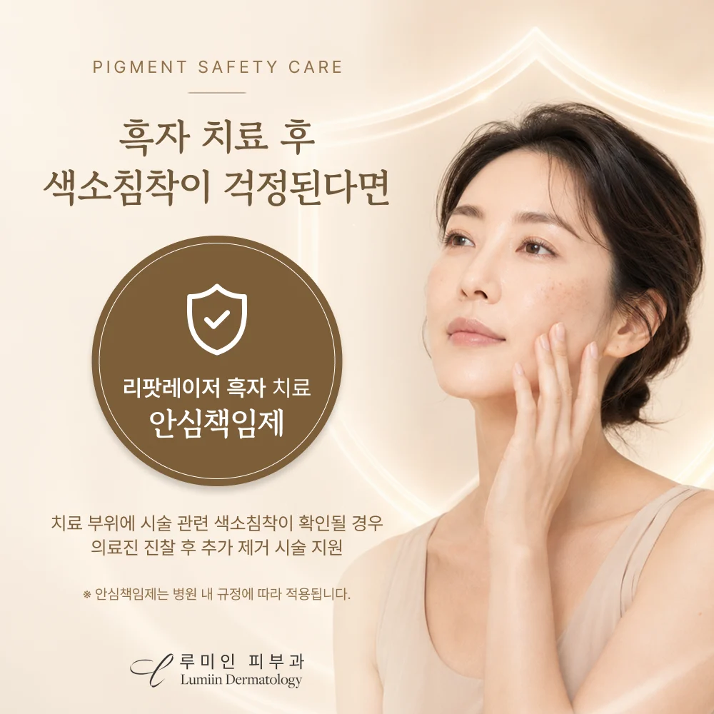 리팟레이저 안심책임제
