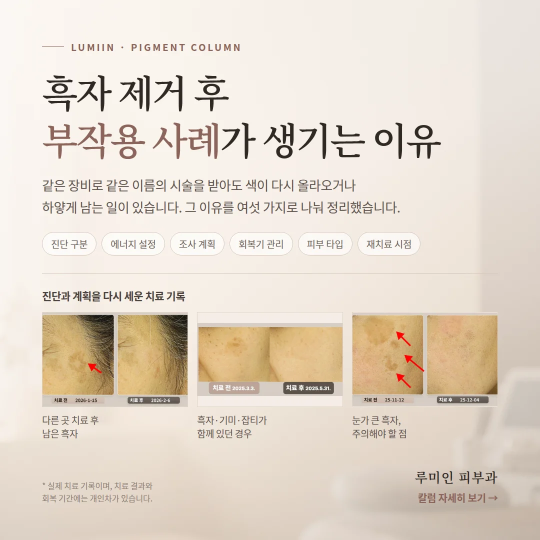 흑자 제거 후 부작용 사례가 생기는 이유