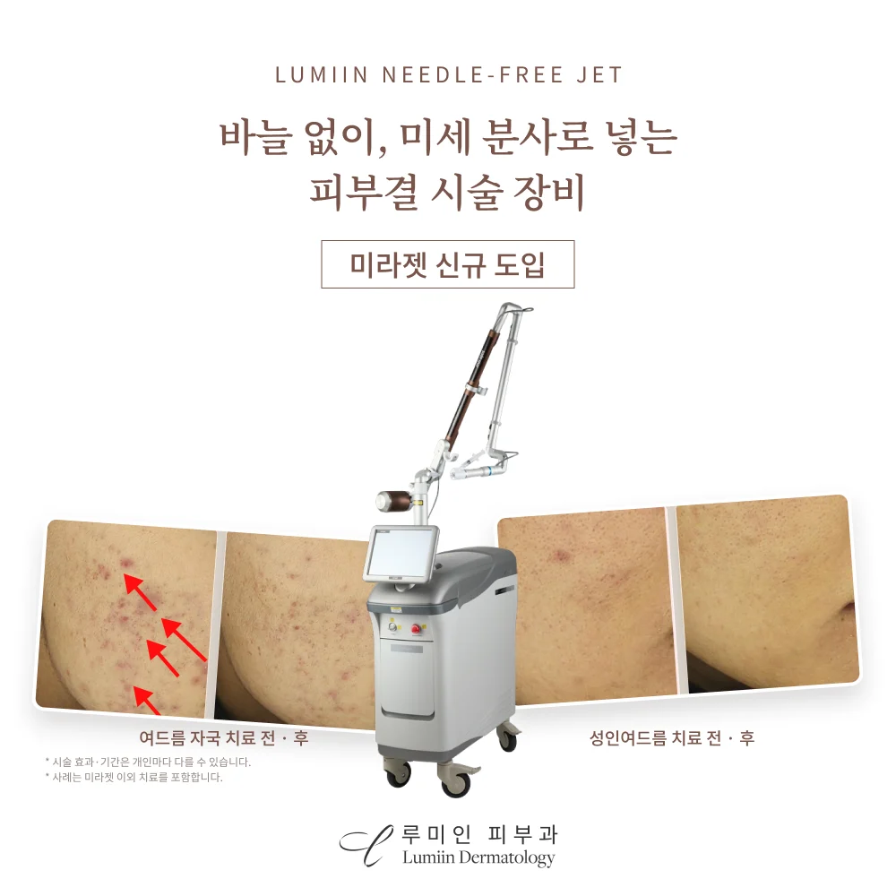미라젯 신규 도입