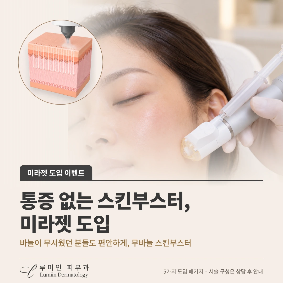 미라젯 도입 이벤트