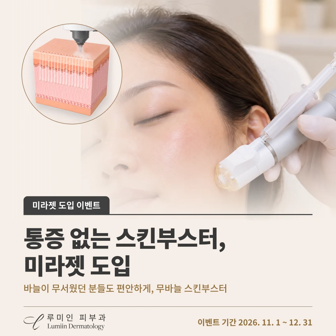 미라젯 도입 이벤트